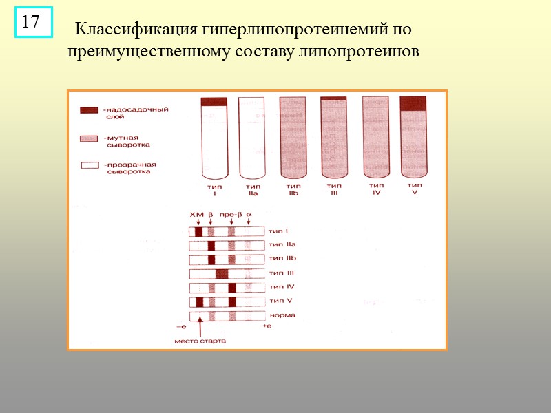 Классификация гиперлипопротеинемий по преимущественному составу липопротеинов 17